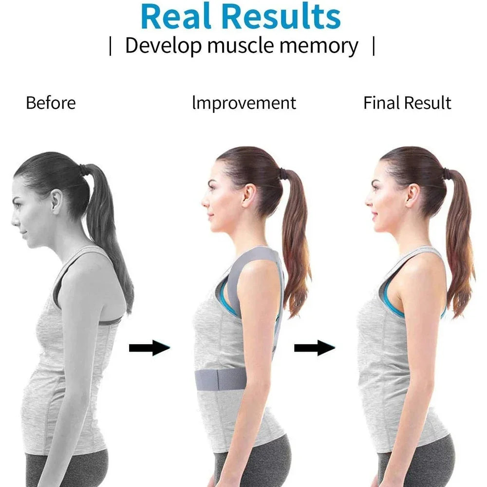 Adjustable Posture Corrector
